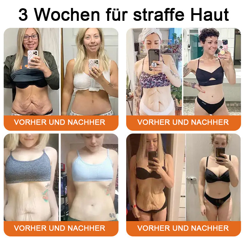 "Hergestellt in Deutschland, Versand aus Deutschland|✅ Offizieller Store✨Lotmay® Bienengift Regenerationscreme 🔥 LETZTER TAG 80% RABATT💎"