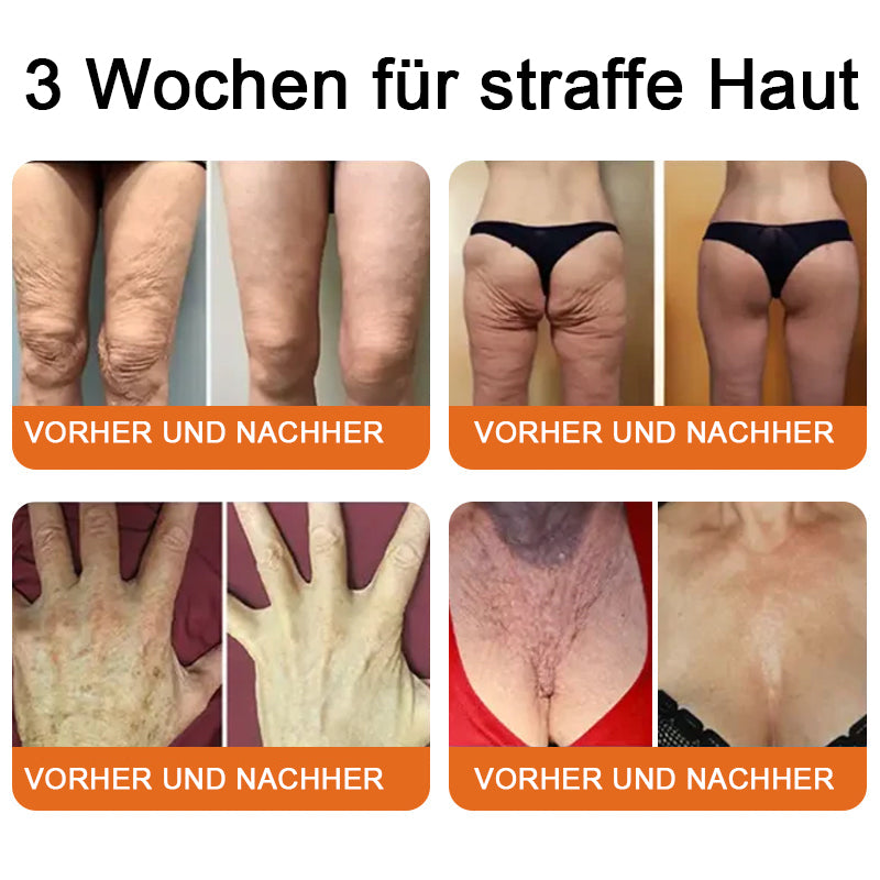 "Hergestellt in Deutschland, Versand aus Deutschland|✅ Offizieller Store✨Lotmay® Bienengift Regenerationscreme 🔥 LETZTER TAG 80% RABATT💎"