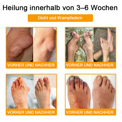 Lotmay® Bienengift Schmerzstillende Gelenk-Reparaturcreme 🐝🐝(Für Senioren & EU-zertifiziert“)