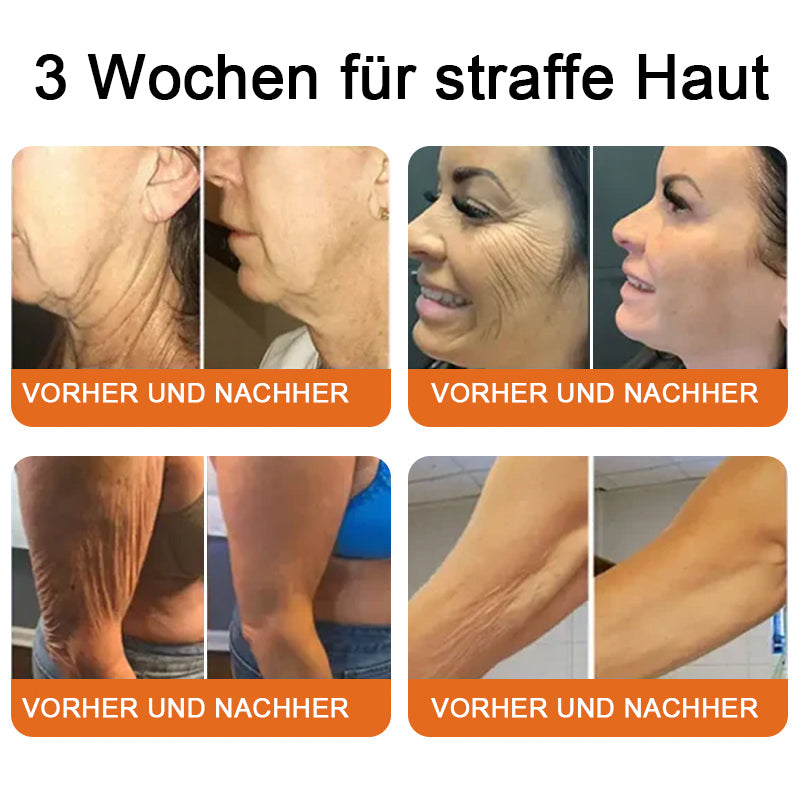 "Hergestellt in Deutschland, Versand aus Deutschland|✅ Offizieller Store✨Lotmay® Bienengift Regenerationscreme 🔥 LETZTER TAG 80% RABATT💎"