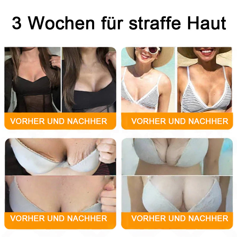 "Hergestellt in Deutschland, Versand aus Deutschland|✅ Offizieller Store✨Lotmay® Bienengift Regenerationscreme 🔥 LETZTER TAG 80% RABATT💎"