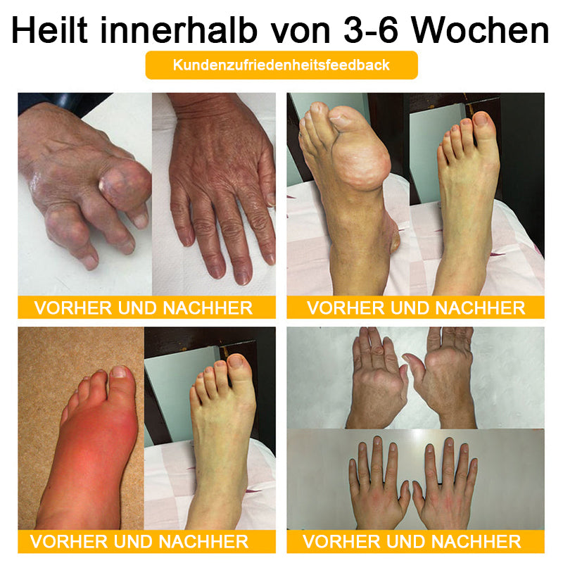 Lotmay® Bienengift Schmerzstillende Gelenk-Reparaturcreme 🐝🐝(Für Senioren & EU-zertifiziert“)