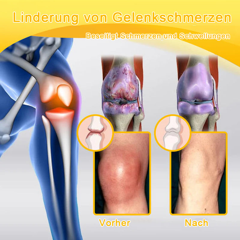 Lotmay® Bienengift Schmerzstillende Gelenk-Reparaturcreme 🐝🐝(Für Senioren & EU-zertifiziert“)