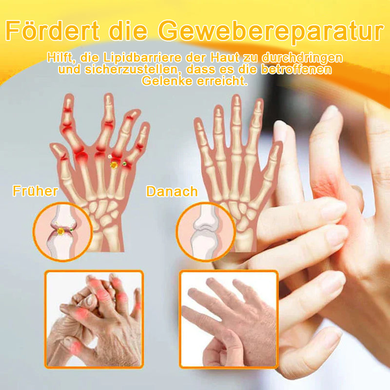Lotmay® Bienengift Schmerzstillende Gelenk-Reparaturcreme 🐝🐝(Für Senioren & EU-zertifiziert“)