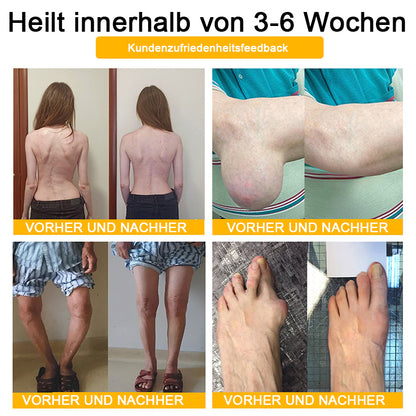 Lotmay® Bienengift Schmerzstillende Gelenk-Reparaturcreme 🐝🐝(Für Senioren & EU-zertifiziert“)