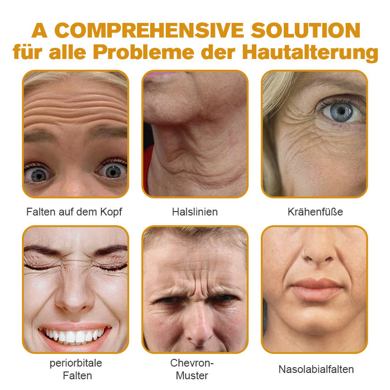 Letzter Tag der Aktion: 70 % Rabatt - ✨Furzero™ Botox Bienenvenom Faltenentfernungscreme