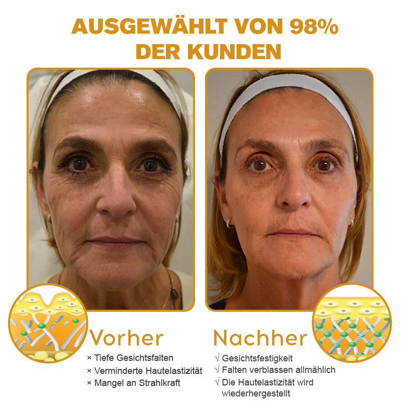Letzter Tag der Aktion: 70 % Rabatt - ✨Furzero™ Botox Bienenvenom Faltenentfernungscreme