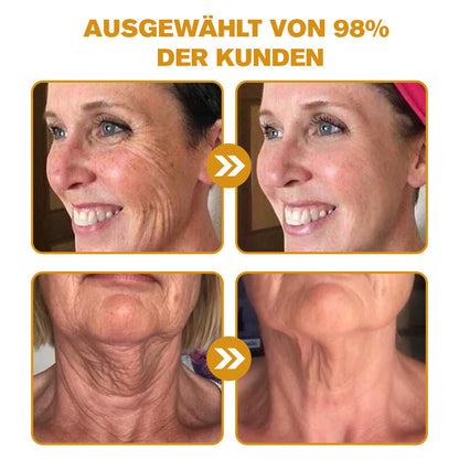 Letzter Tag der Aktion: 70 % Rabatt - ✨Furzero™ Botox Bienenvenom Faltenentfernungscreme