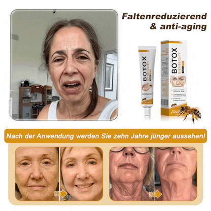 Letzter Tag der Aktion: 70 % Rabatt - ✨Furzero™ Botox Bienenvenom Faltenentfernungscreme